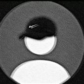 Ex